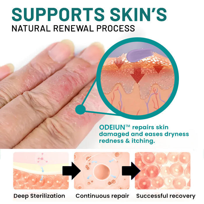 ODEIUN™ Probiotic + B 24-7 Moisture Eczema Relief Cream